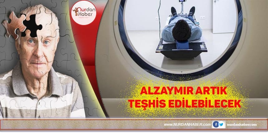 Alzaymırı erken teşhis yöntemi geliştirildi