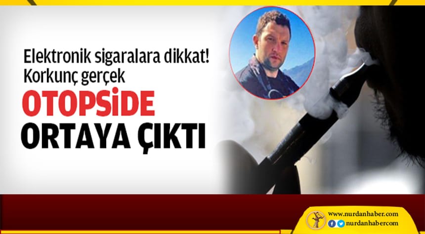 Otopside neden öldüğü anlaşıldı!