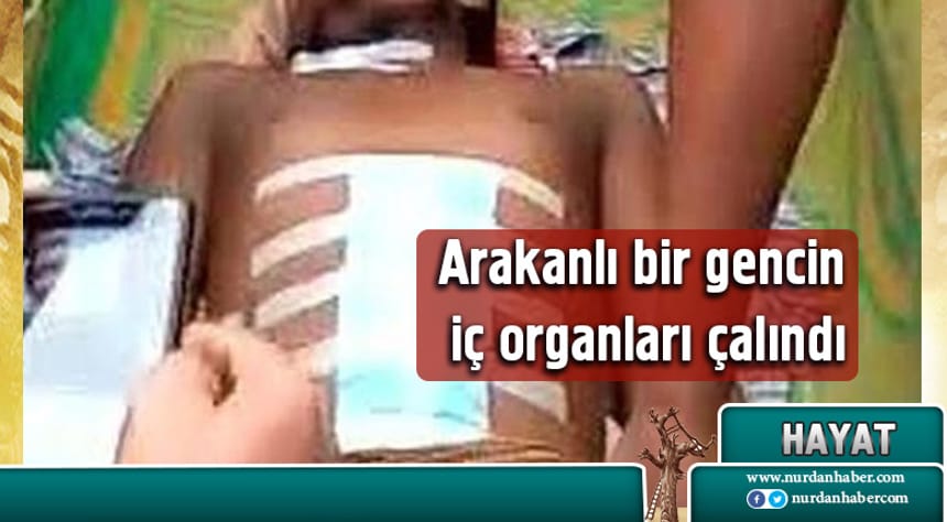 Müslümanların Organları Çalınıyor!