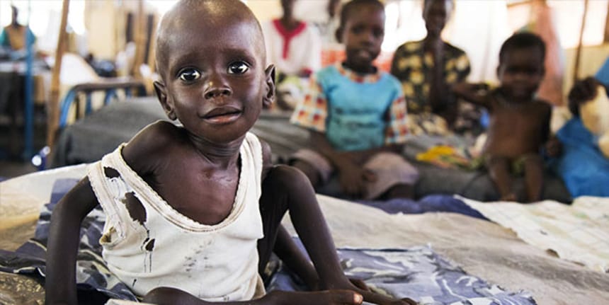 Nijerya’da 29 çocuk yetersiz beslenme yüzünden öldü